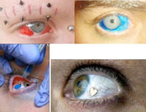 Nuova tendenza: tatuaggi agli occhi. Sempre più italiani lo fanno