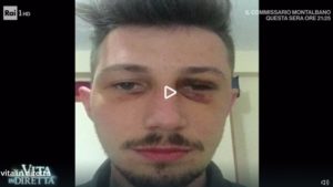 VIDEO | Alla “Vita in diretta” il  24enne di Montepaone picchiato fuori dal locale: “Io aggredito a calci e pugni come ad Alatri”