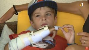 Bambino francese di 9 anni dà da mangiare allo squalo con le mani e viene ferito gravemente al braccio