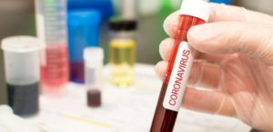 Coronavirus – Salgono a 7 i contagiati in Calabria