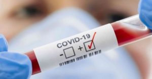 Parrucchiera positiva al coronavirus in Calabria, si cercano i clienti
