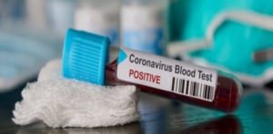 Coronavirus, nuovo caso di contagio a Reggio Calabria