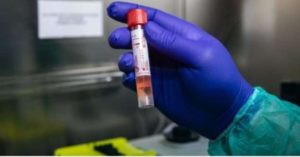 Coronavirus, 5 le vittime registrate in Italia nelle ultime 24 ore