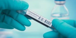 Coronavirus, nuovo bollettino della Protezione civile nazionale. 333 i decessi nelle ultime 24 ore