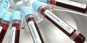 Coronavirus, ultimo bollettino della Regione Calabria. 1.011 casi accertati (+20 rispetto a ieri)