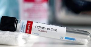 Coronavirus, ultimo bollettino della Regione Calabria. 859 casi positivi (+26 rispetto a ieri), resta a 60 il conto dei decessi