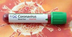 Coronavirus, sono 198 i contagi registrati in Calabria nell’ultimo giorno