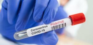 Covid-19, in Calabria 460 nuovi contagi e 2 decessi