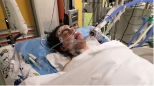Giovane calabrese operato al cervello in Spagna, intervento di 11 ore